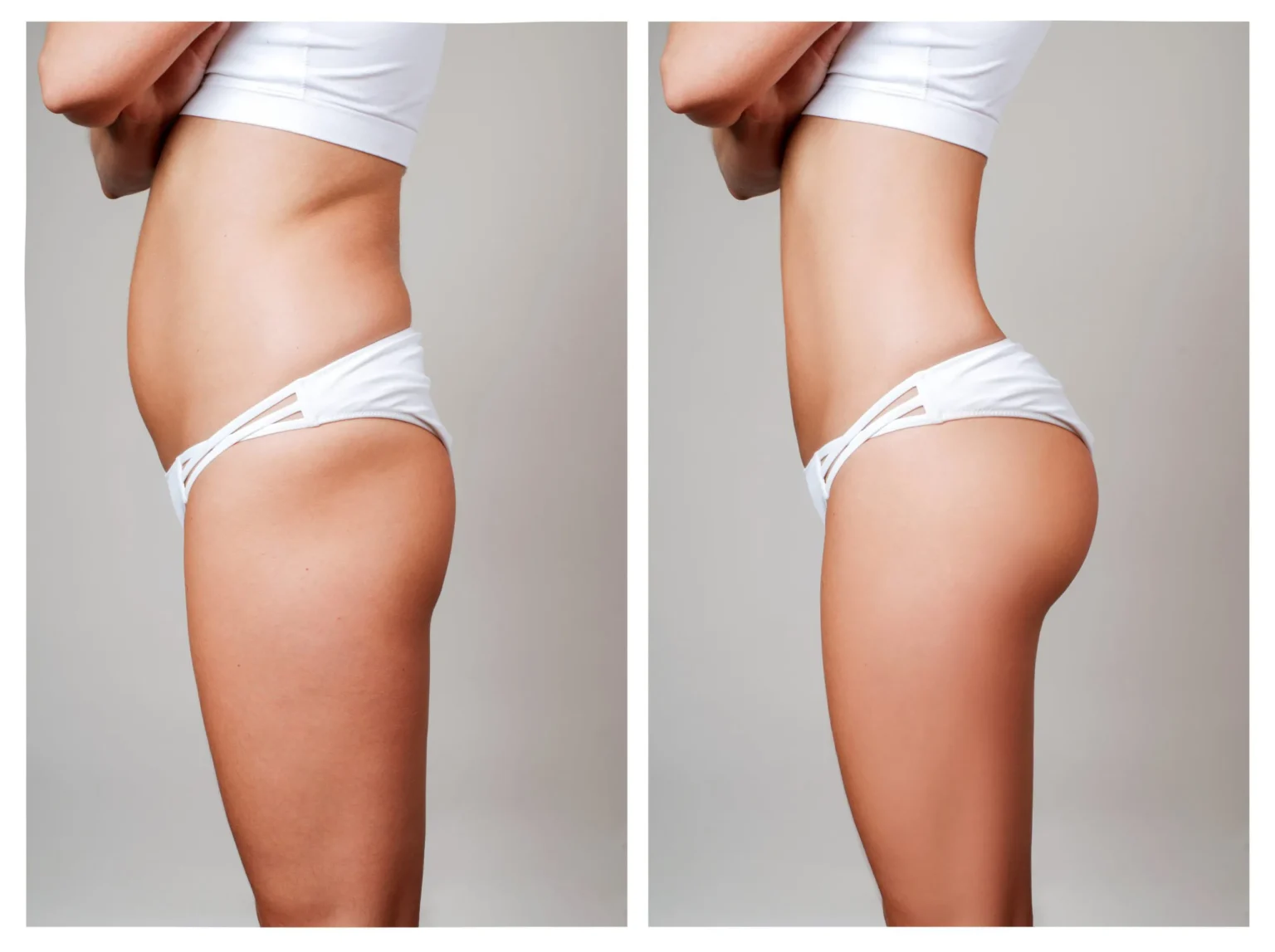 Body Tite example